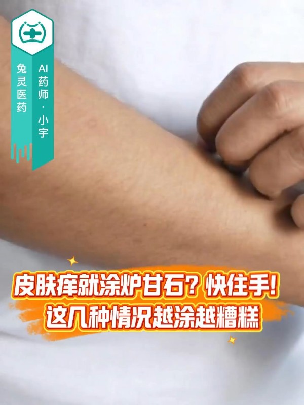 皮肤痒就涂炉甘石？快住手！这几种情况越涂越糟糕
