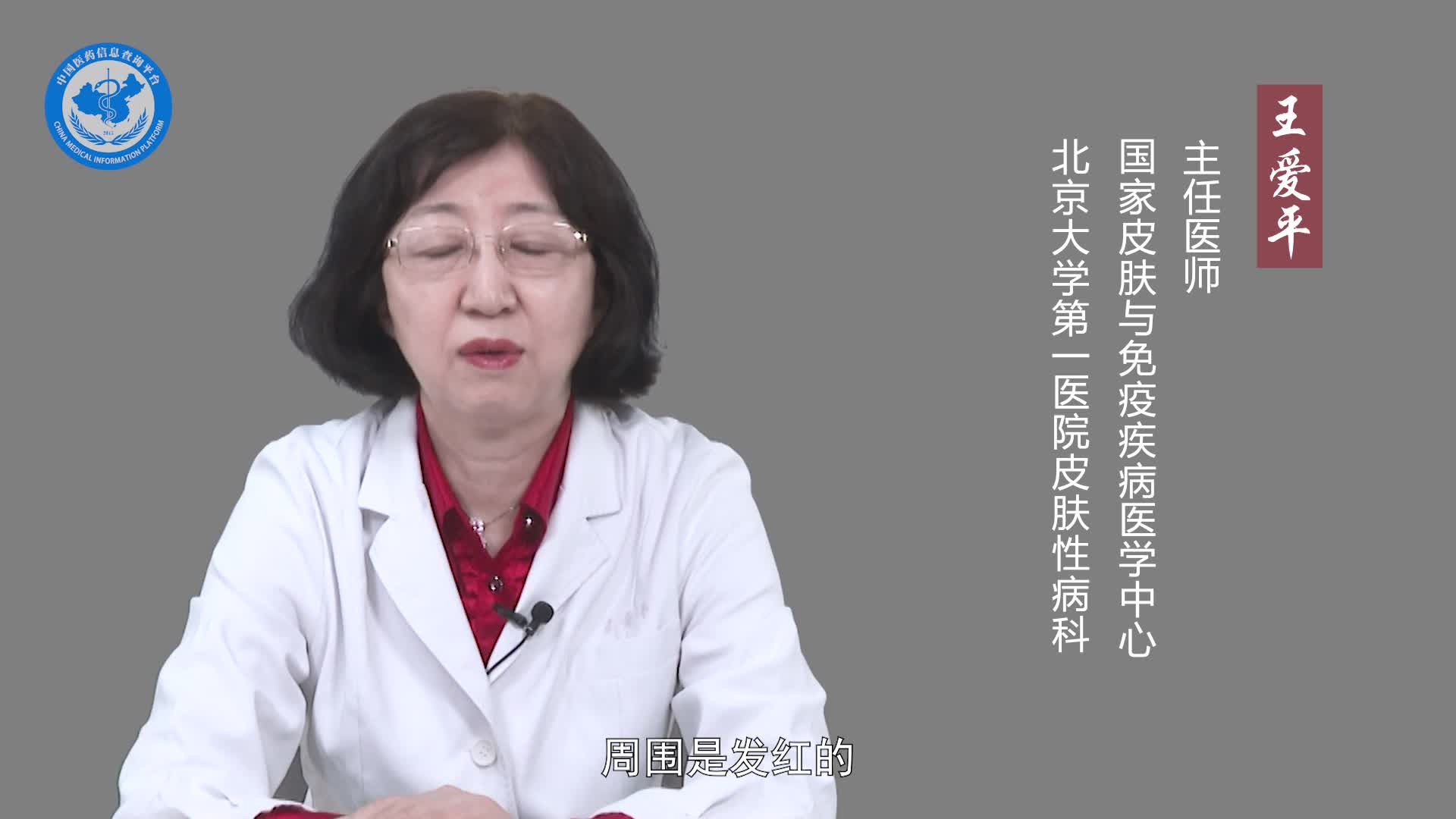 人被传染了狗癣有什么症状？